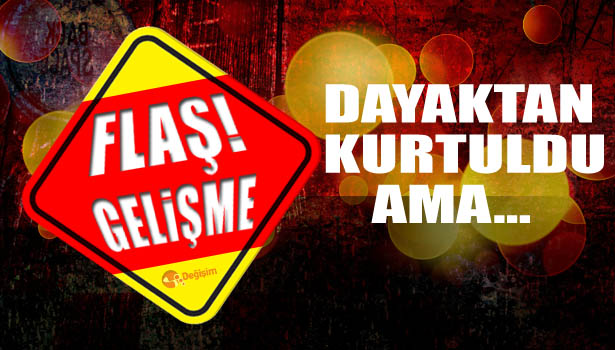 DAYAKTAN KURTULDU, SICAK SU İLE YANACAKTI