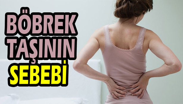 BÖBREK TAŞININ SEBEBİ SICAK İKLİM