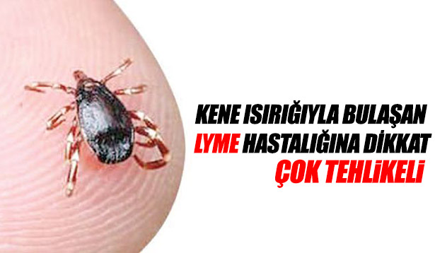 KENE ISIRIĞIYLA BULAŞAN LYME, AIDS'İ KATLADI