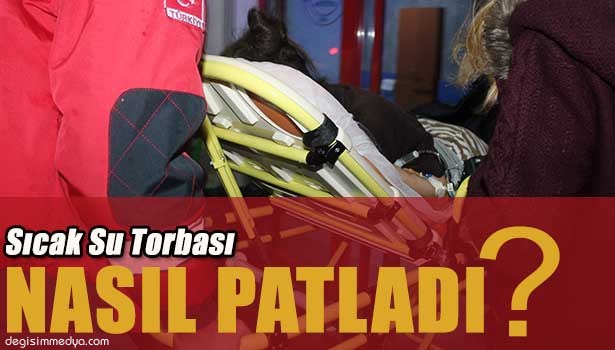 SICAK SU TORBASININ PATLAMASI SONUCU YARALANDI