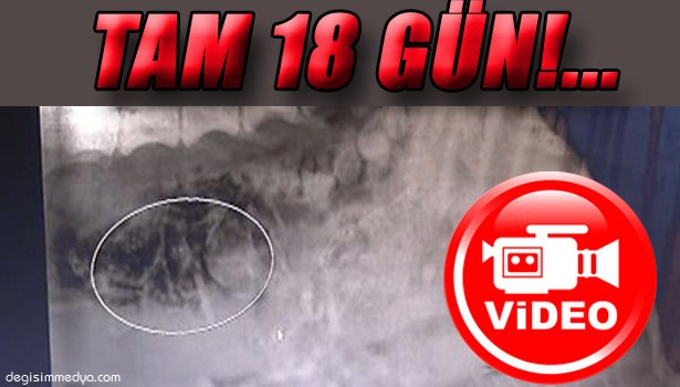 BARAK CİNSİ AV KÖPEĞİ, 18 GÜN ÖLÜ YAVRULARINI KARNINDA TAŞIMIŞ