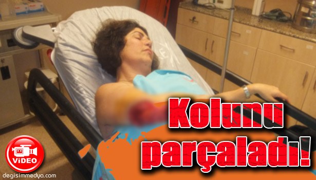 KÖPEĞİN SALDIRDIĞI KADININ KOLU PARÇALANDI