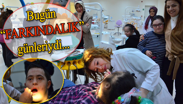 DOWN SENDROMLU ÇOCUKLARIN DİŞ TARAMASINDAN RENKLİ GÖRÜNTÜLER