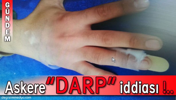 KIŞLADA ASKERE DARP İDDİASI !..