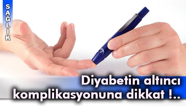 "MANTAR ENFEKSİYONLARI, AĞIZDA VE DİLDE YANMA VE AĞRI DİYABET BELİRTİSİ OLABİLİR"