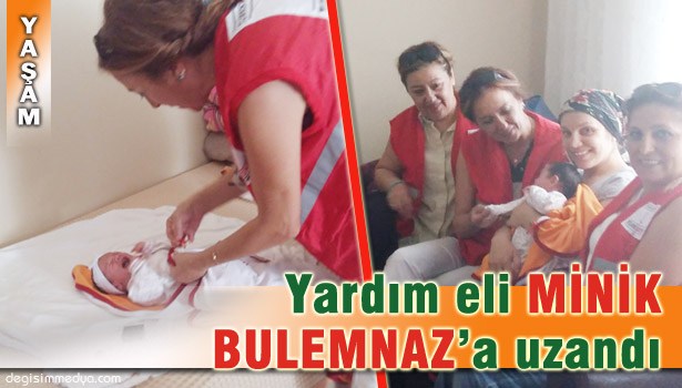 HEYELAN MAĞDURU MİNİK BULEMNAZ'A KIZILAY'DAN ŞEFKAT ELİ