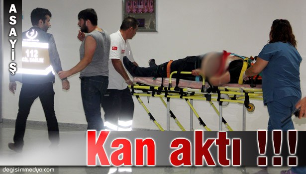 SERVİSÇİLERİN KAVGASINDA KAN AKTI: 1'İ AĞIR 3 YARALI !..