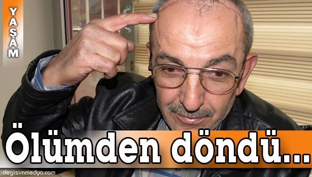 GÖZ RAHATSIZLIĞI İÇİN GİTTİ, BEYNİNDE TÜMÖR ÇIKTI