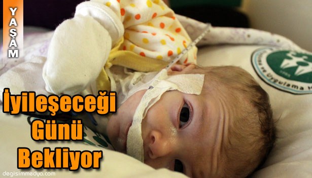 YAĞIZ BEBEK İYİLEŞECEĞİ GÜNÜ BEKLİYOR