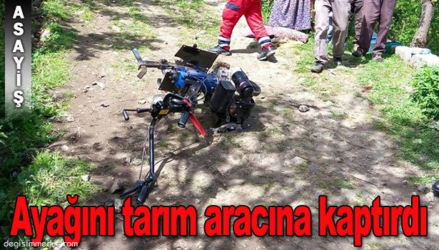 AYAĞINI TARIM ARACINA KAPTIRDI