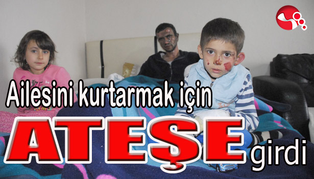 AİLESİNİ KURTARMAK İÇİN ATEŞE GİRDİ...