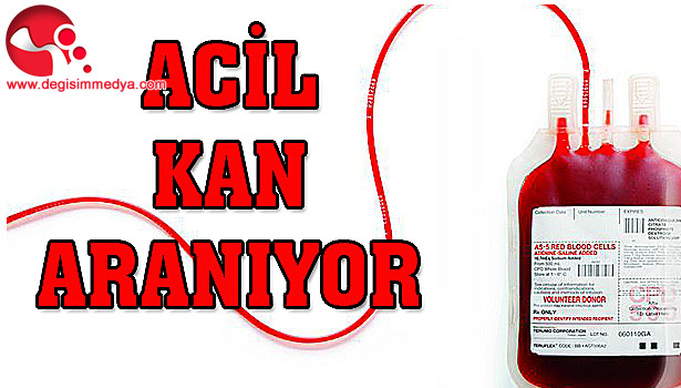 ÇOK ACELE KANA İHTİYAÇ VAR