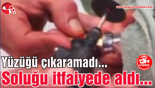 Yüzüğü çıkaramadı, soluğu itfaiyede aldı...