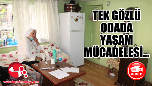 Tek gözlü oda da yaşam mücadelesi veriyor...