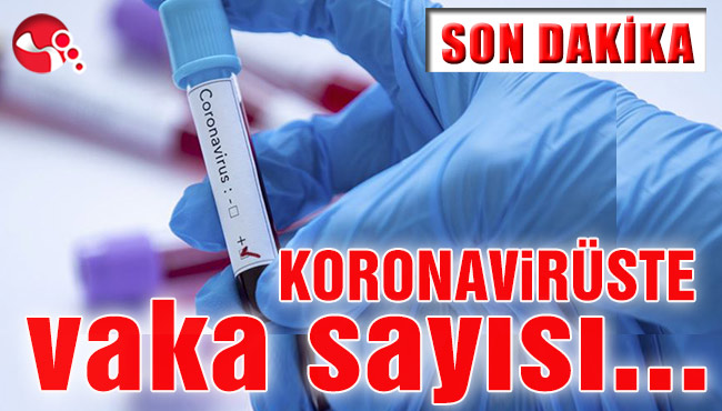 Koronavirüste vaka sayısı…