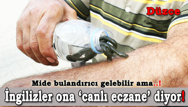 BAZI HASTALIKLARA 'SÜLÜK' FORMÜLÜ !