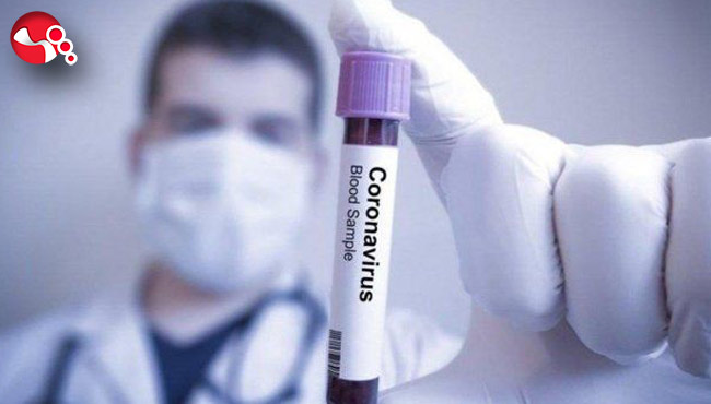 CoronaVirüs 1 can daha aldı: Hastanede öldü