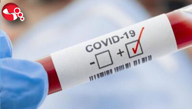 Yatalak yaşlı hastada COVİD-19 şüphesi...