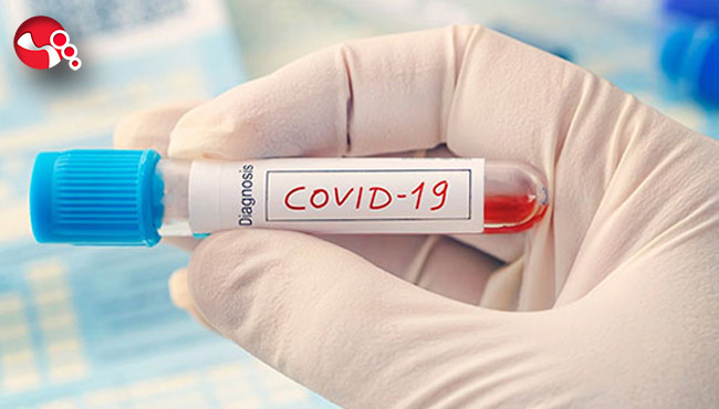 DSÖ: "Dünya çapında her 10 kişiden 1'i virüs kapmış olabilir..."