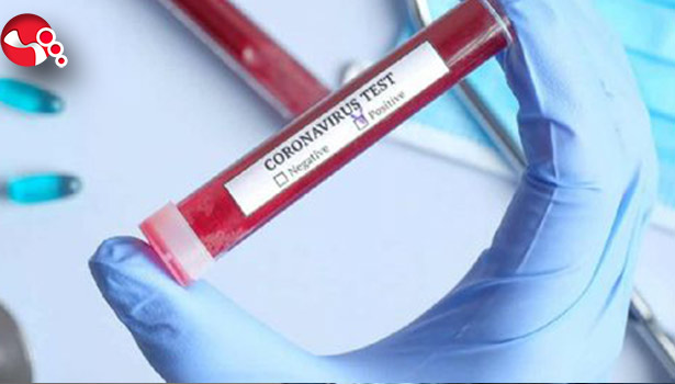 Misafirliğe gelmişti... KOVİD 19 belirtileriyle...