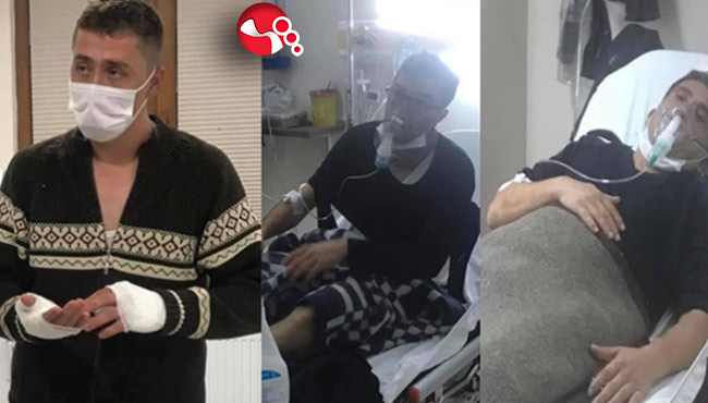 Üçüde yangında yaralanmışlardı!...