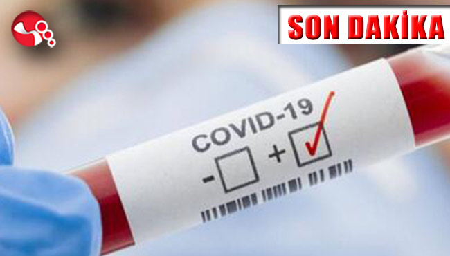 3 gün içinde yaşamını yitirdi! Sayı 97 oldu...