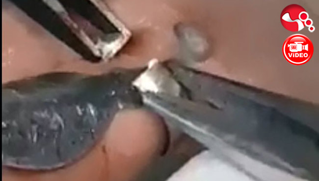 Yüzük operasyonu!..