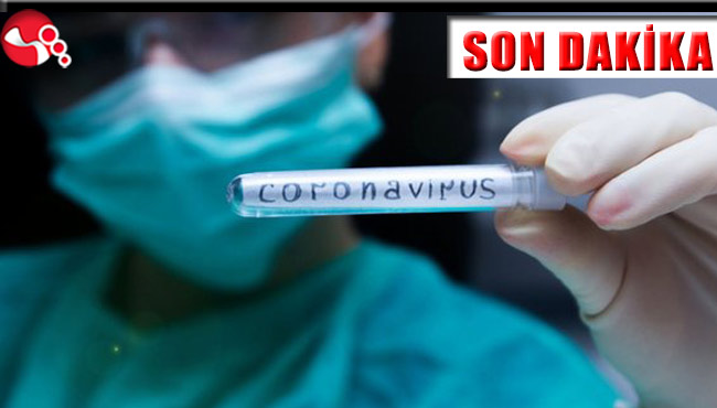 Uzun aradan sonra geriledi...