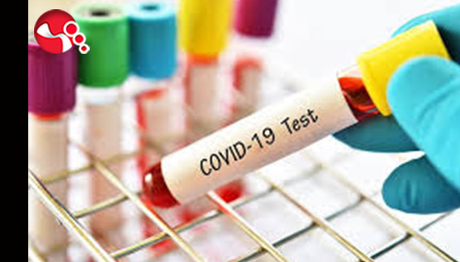 Vaka sayılarında NERELERDE DÜŞÜŞ NERELERDE ARTIŞLAR VAR?