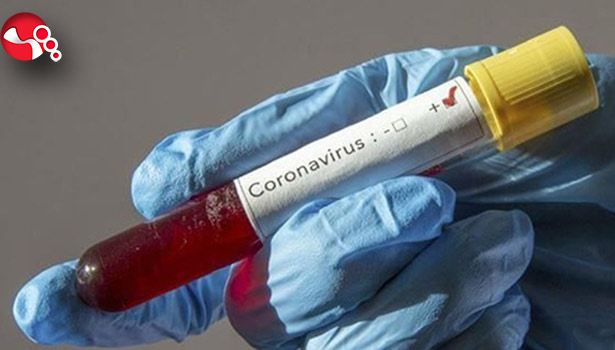 Zonguldak İl ve İlçelerde vaka sayıları...