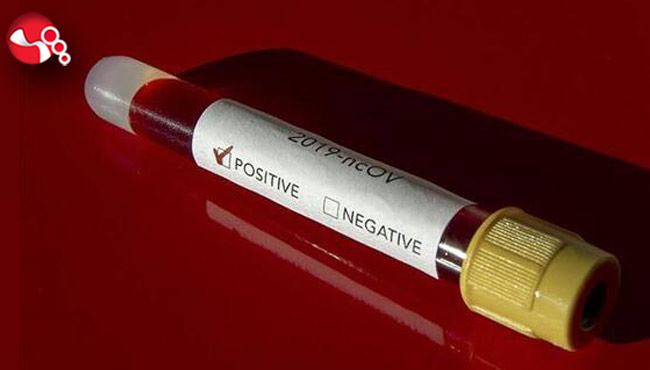 Belediyede vaka sayısı artıyor!..