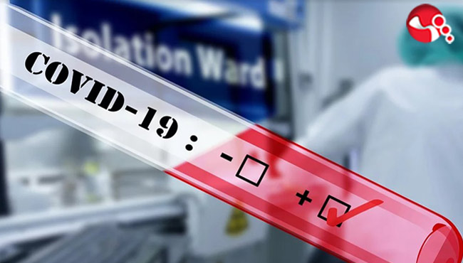 Nurşen Güdül Koronavirüse yenik düştü...