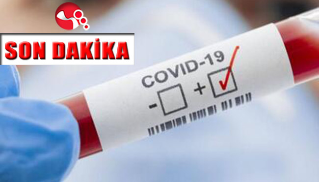 COVİD-19 bir can daha aldı!!!
