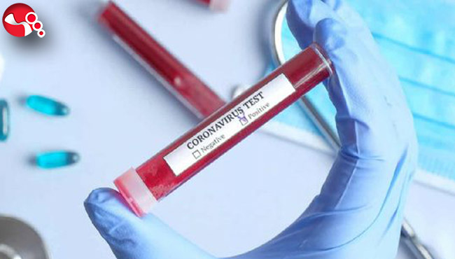 Koronavirüste yayılım hızı ne durumda?