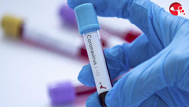 İki günde iki can kaybı!!!