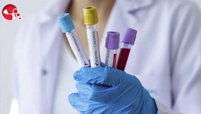 Dün ve bugün toplam 4 can kaybı daha...