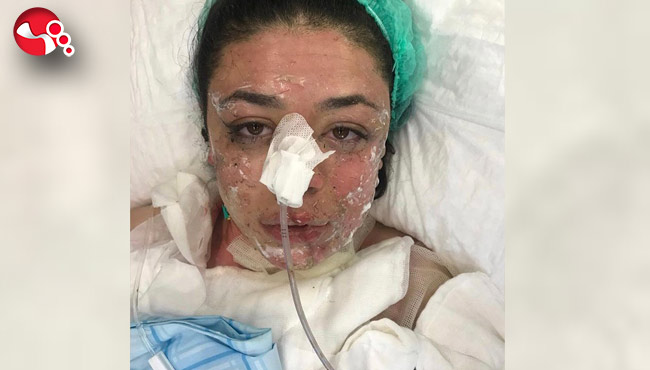 Gizem Hemşirenin son hali...