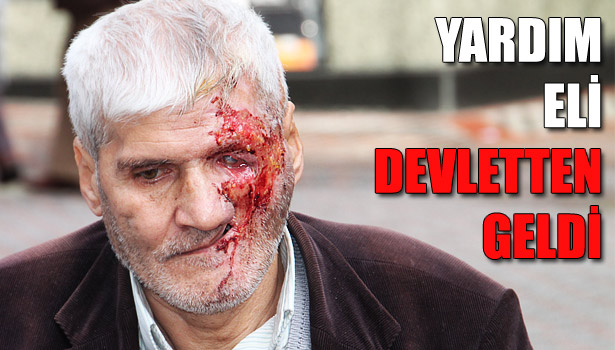 YÜZ NAKLİ İSTEYEN ŞADİ DURMUŞ' A DEVLET ELİ UZANIYOR