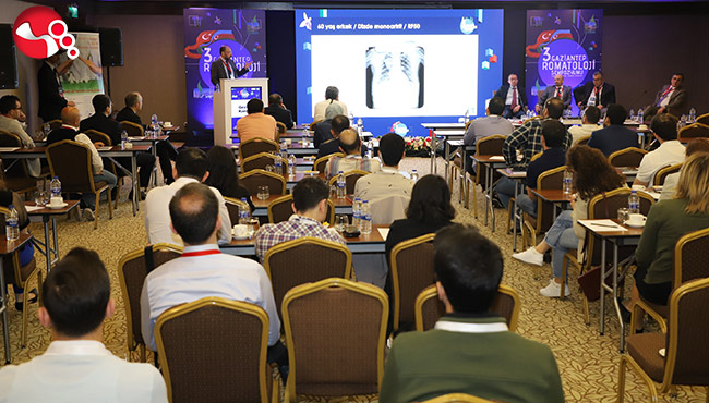 Prof. Dr. Koca, “Sakatlıklara neden olabilir”