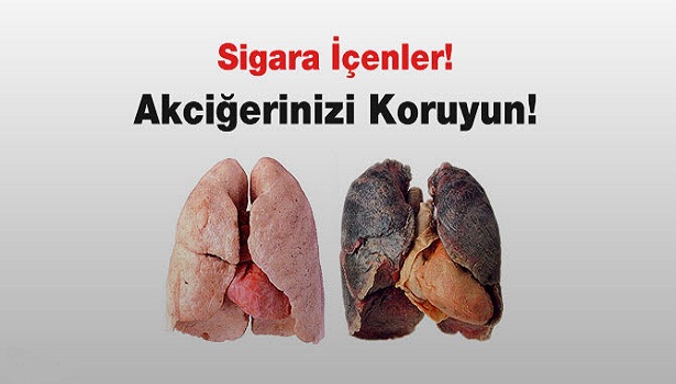 SİGARA VE SAĞLIĞIMIZ
