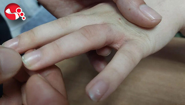 Parmağına sıkışan yüzüğü AFAD çıkarttı!..