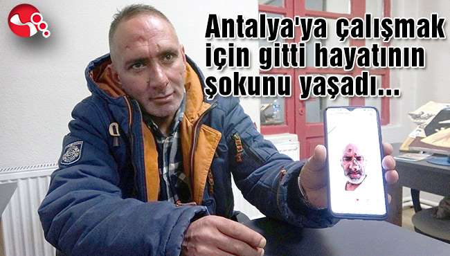 TANINAMAYACAK HALE GELDİ