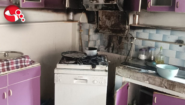 Yangında hastanelik oldu