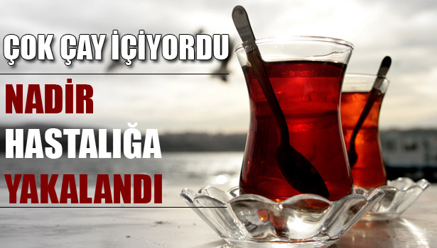 ÇOK ÇAY İÇMEKTEN NADİR HASTALIĞA YAKALANDI