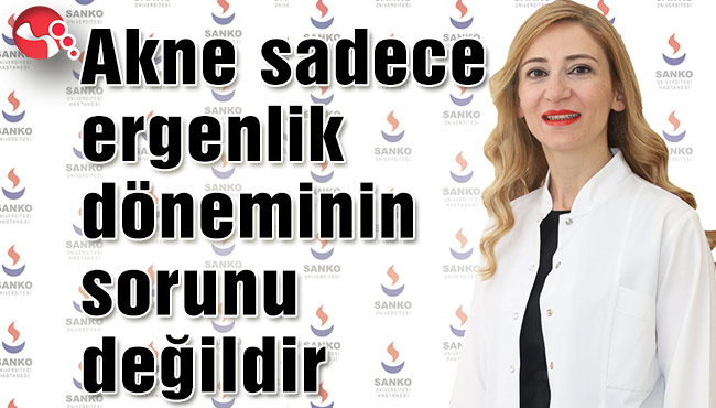 Akne sadece ergenlik döneminin sorunu değildir