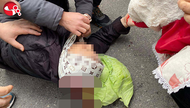 Yaşlı kadının başına tente demiri düştü!