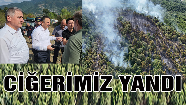 CİĞERİMİZ YANDI