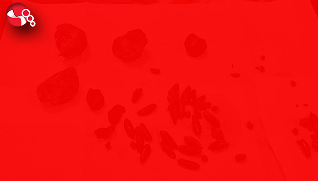 92 yaşındaki kadının midesi ve bağırsaklarından çıkanlar şok etti…