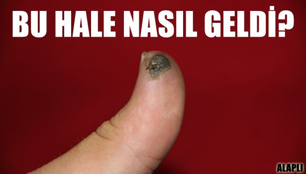 CEP TELEFONU BATARYASI BOMBA GİBİ PATLADI