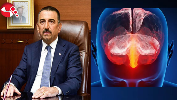Vali Hacıbektaşoğlu'ndan menenjitle ilgili açıklama!....